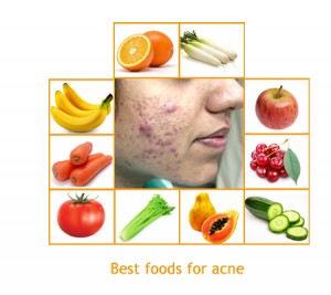 10 Best foods for acne free skin