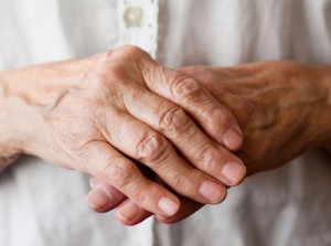 Arthritic-hands