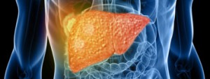 Tips-To-Prevent-Liver-Cancer