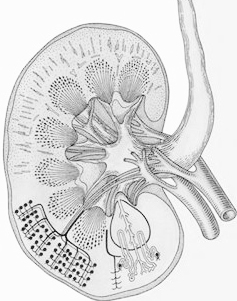 Nephrotic- Syndrome-Symptoms