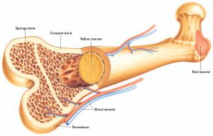 Aplastic anemia
