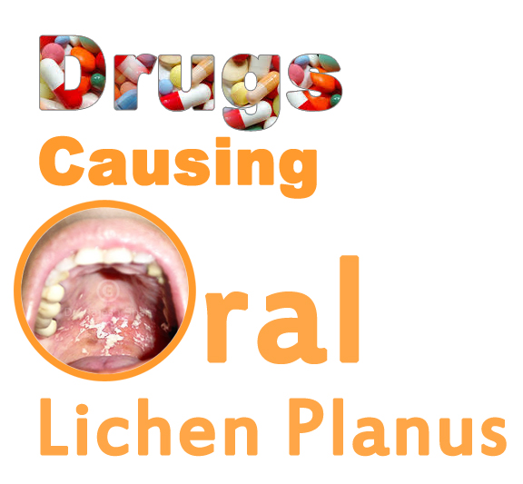 Drugs that cause oral Lichen Planus