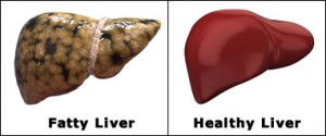 fatty-healthy-liver