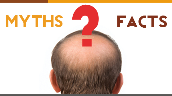 Myths & Facts Related to Hair Loss
