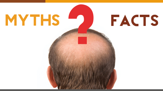 Myths & Facts Related to Hair Loss Myths & Facts Related to Hair Loss