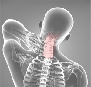 neck-pain