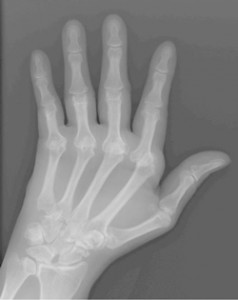 ra-x-ray