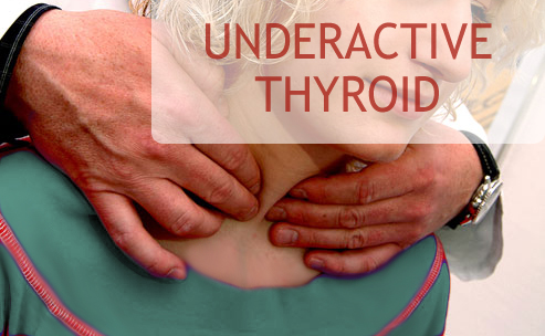 underactive thyriod