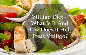 vitiligo-diet