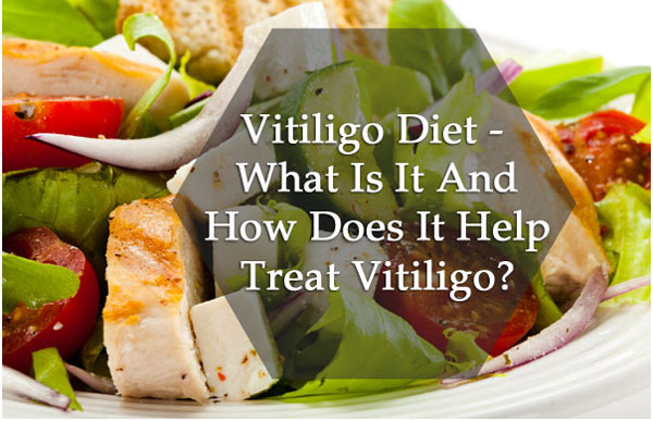 Vitiligo Diet Chart In Hindi