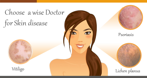 Choose a wise doctor for skin treatment