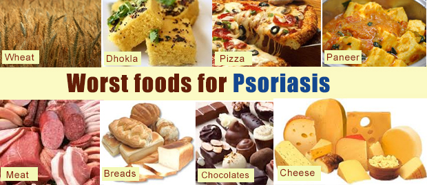 Food to Avoid in Psoriasis