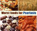 Worst foods for Psoriasis