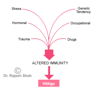 vitiligo-causes-01