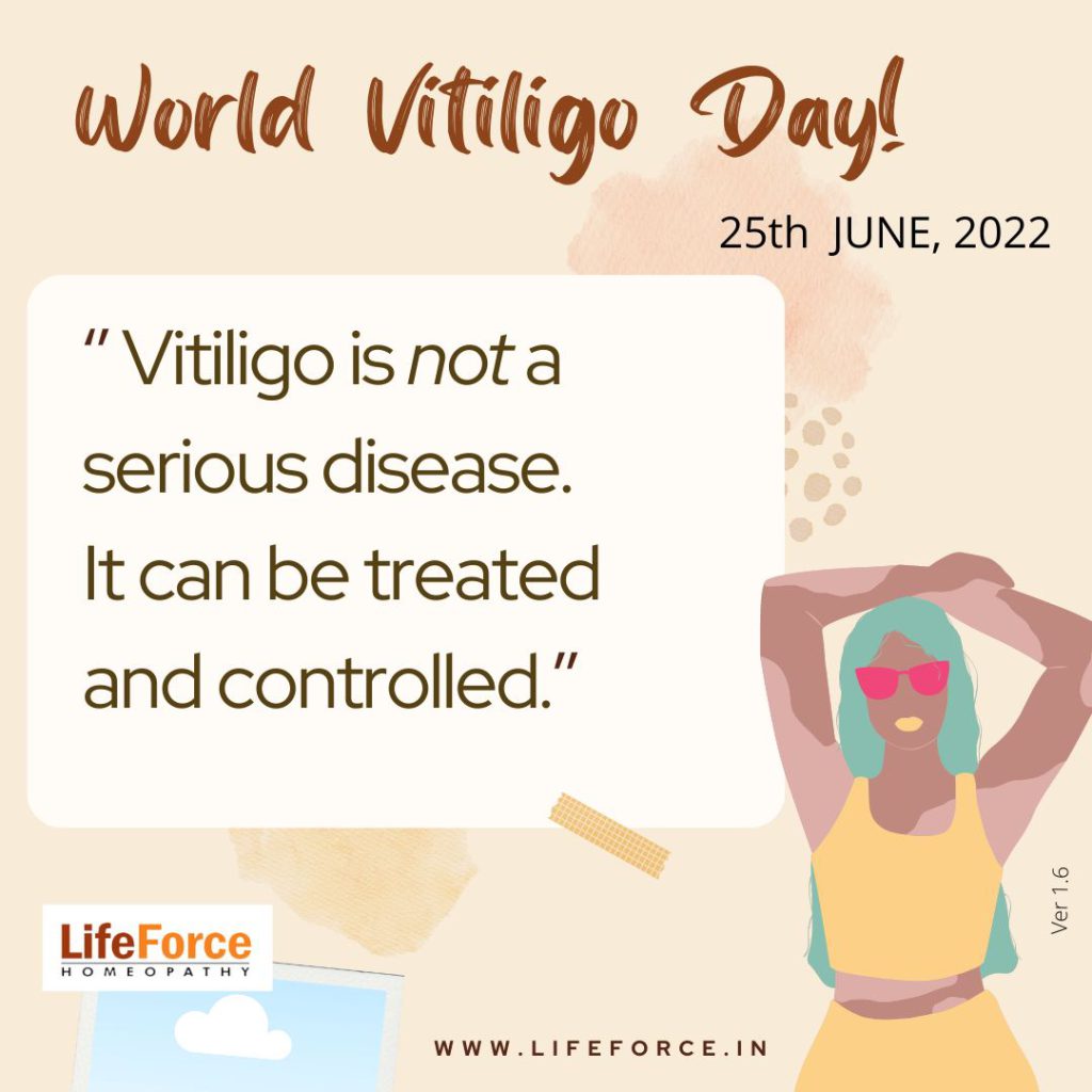 Let’s Celebrate World Vitiligo Day – 25th June 2022 With Proper Care