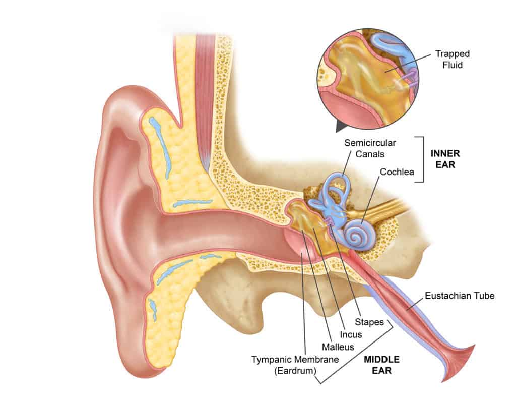 What Is The Antibiotic Of Choice For Treatment Of Acute Otitis Media?