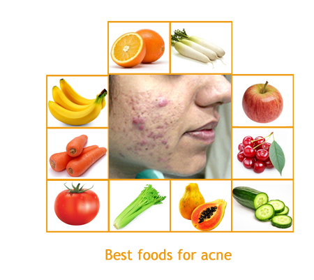 acne pimples