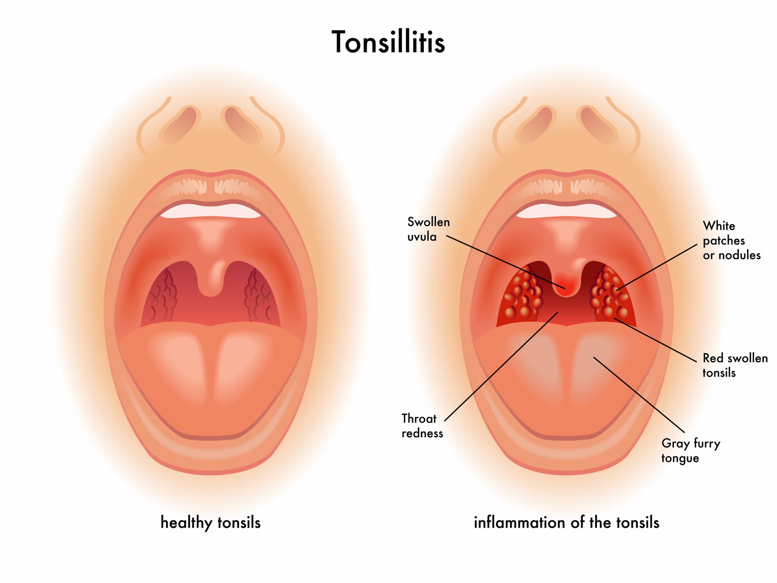 what will smoking one cigarette do Every cigarette does more than harm the lungs. It gradually weakens the  heart, disrupts circulation, and increases the risk of cancer, stroke, and  respiratory failure over time. The impact of tobacco extends