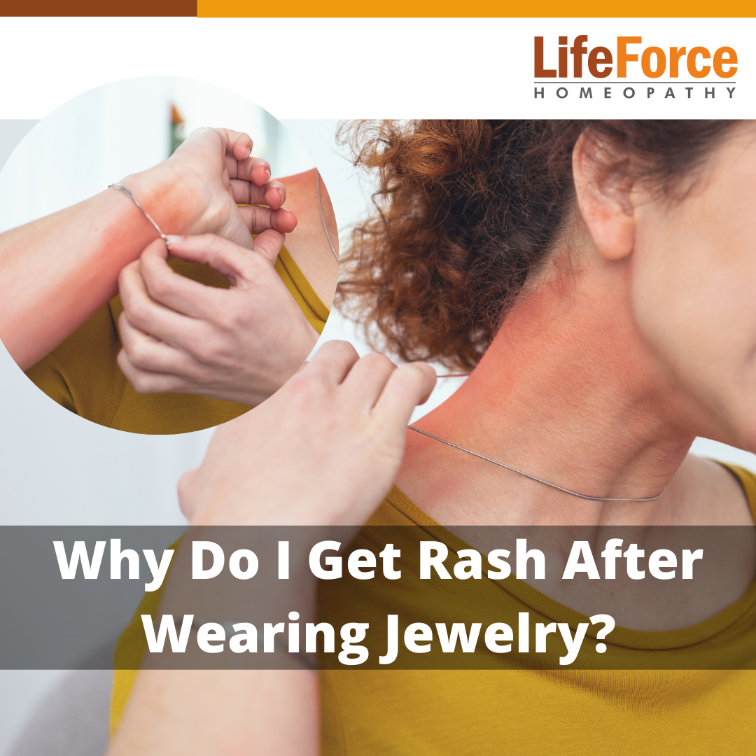 Diamond Pattern Rash Why Do I Get Rash After Wearing Jewelry?