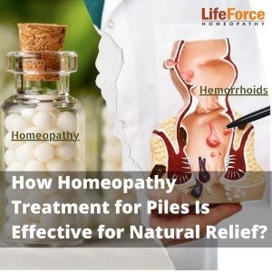 How Homeopathy Treatment for Piles Is Effective for Natural Relief?