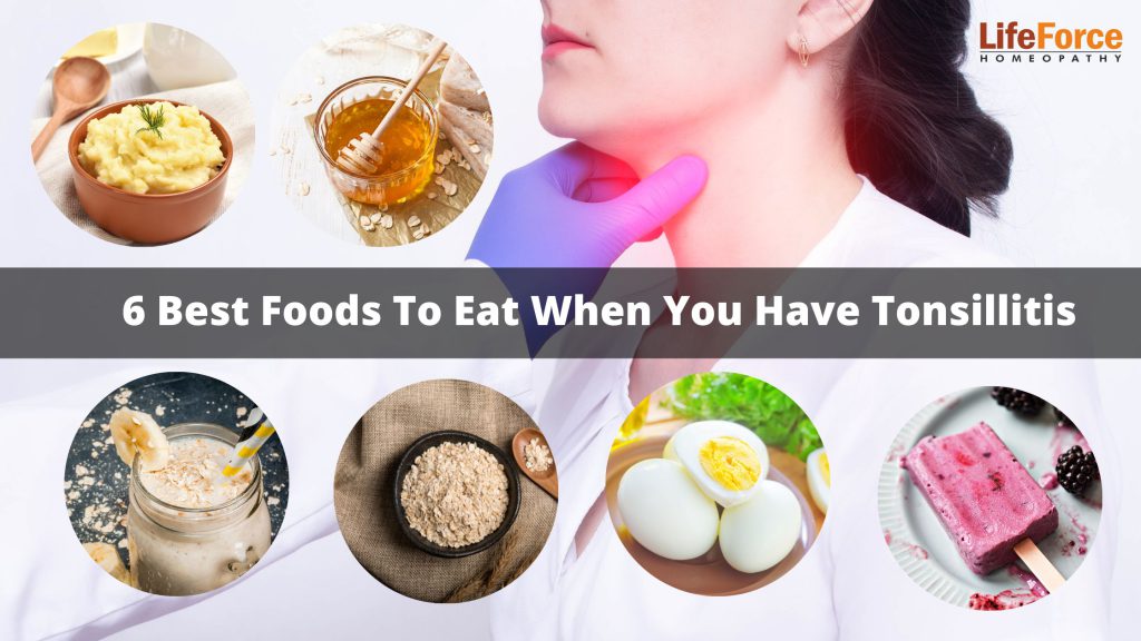 6 Best Foods To Eat When You Have Tonsillitis
