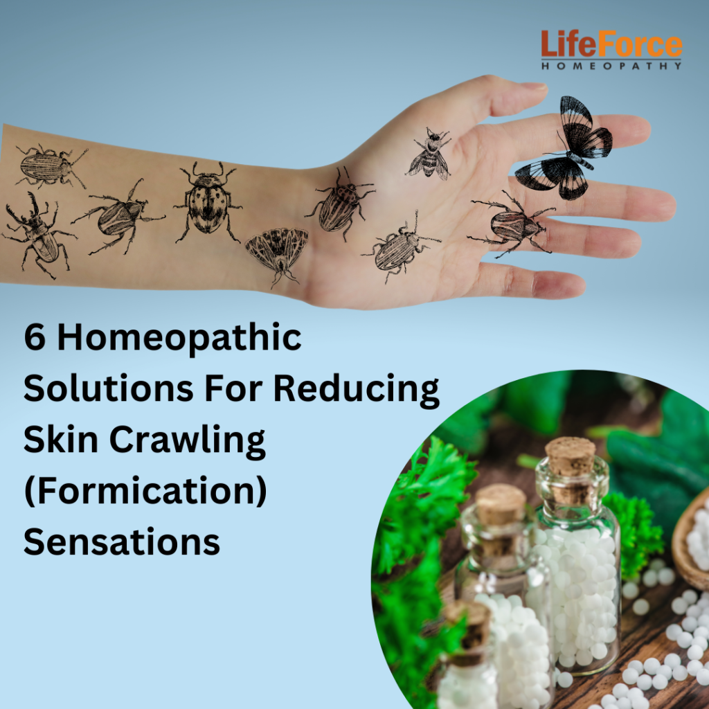 6 Homeopathic Solutions For Reducing Skin Crawling (Formication) Sensations