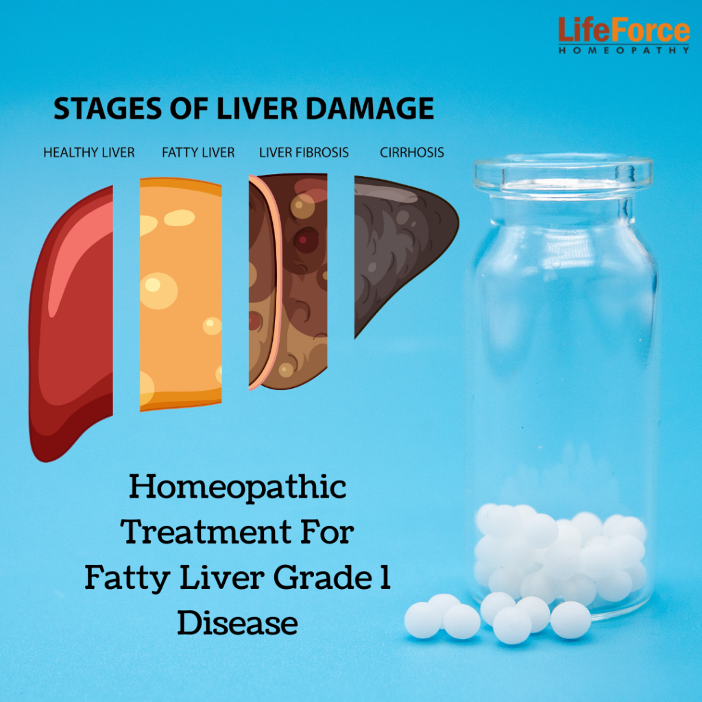 Homeopathic Treatment For Fatty Liver Grade 1 Disease