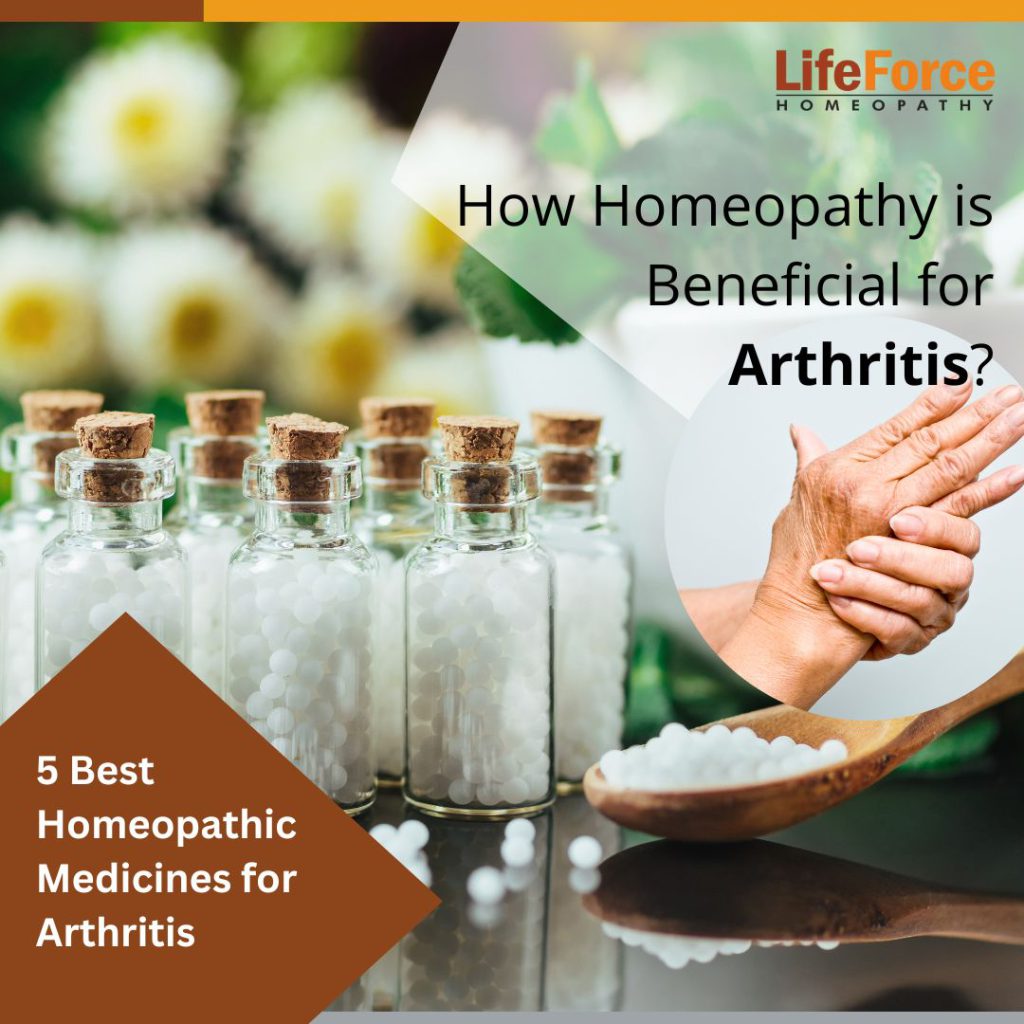 How Homeopathy is Beneficial for Arthritis? – Overview and Details