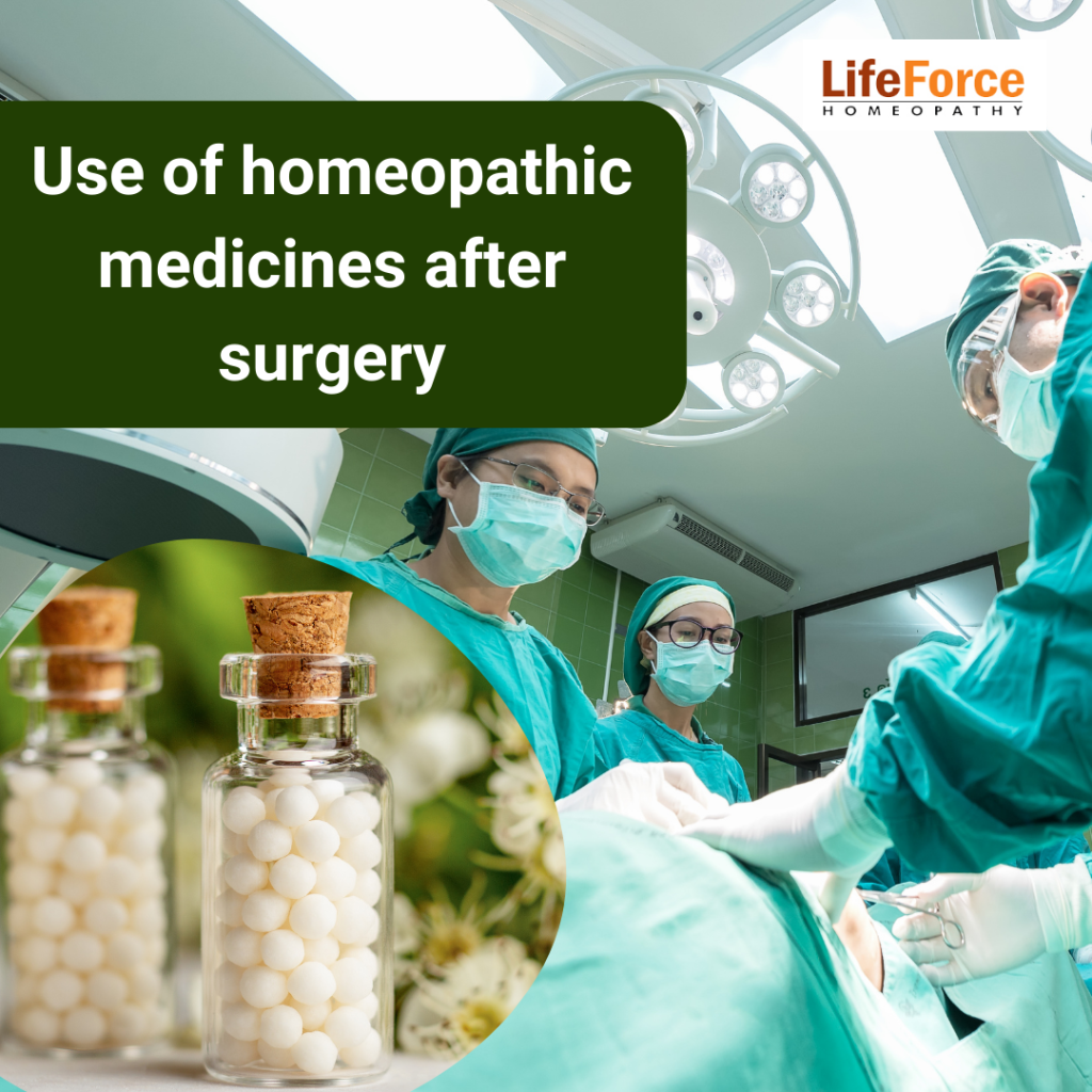 Use of homeopathic medicines after surgery