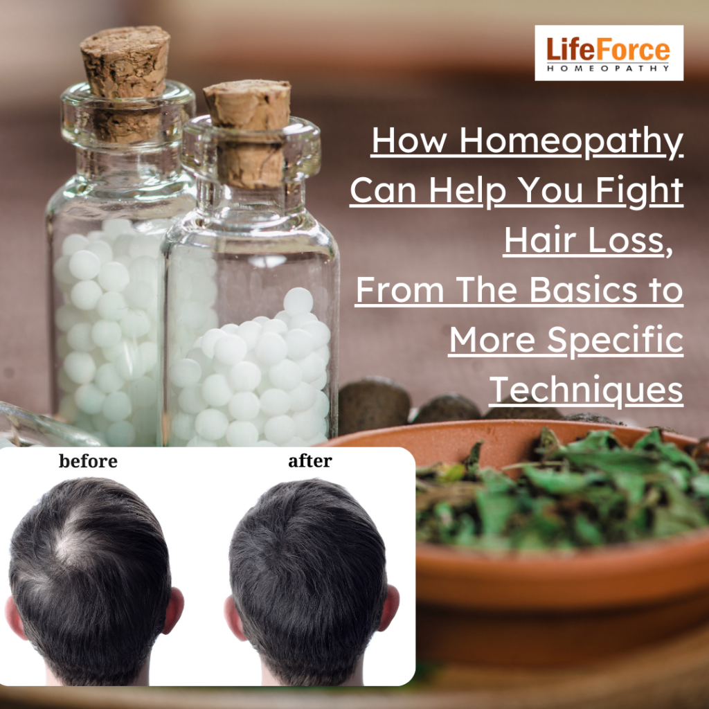 How Homeopathy Can Help You Fight Hair Loss
