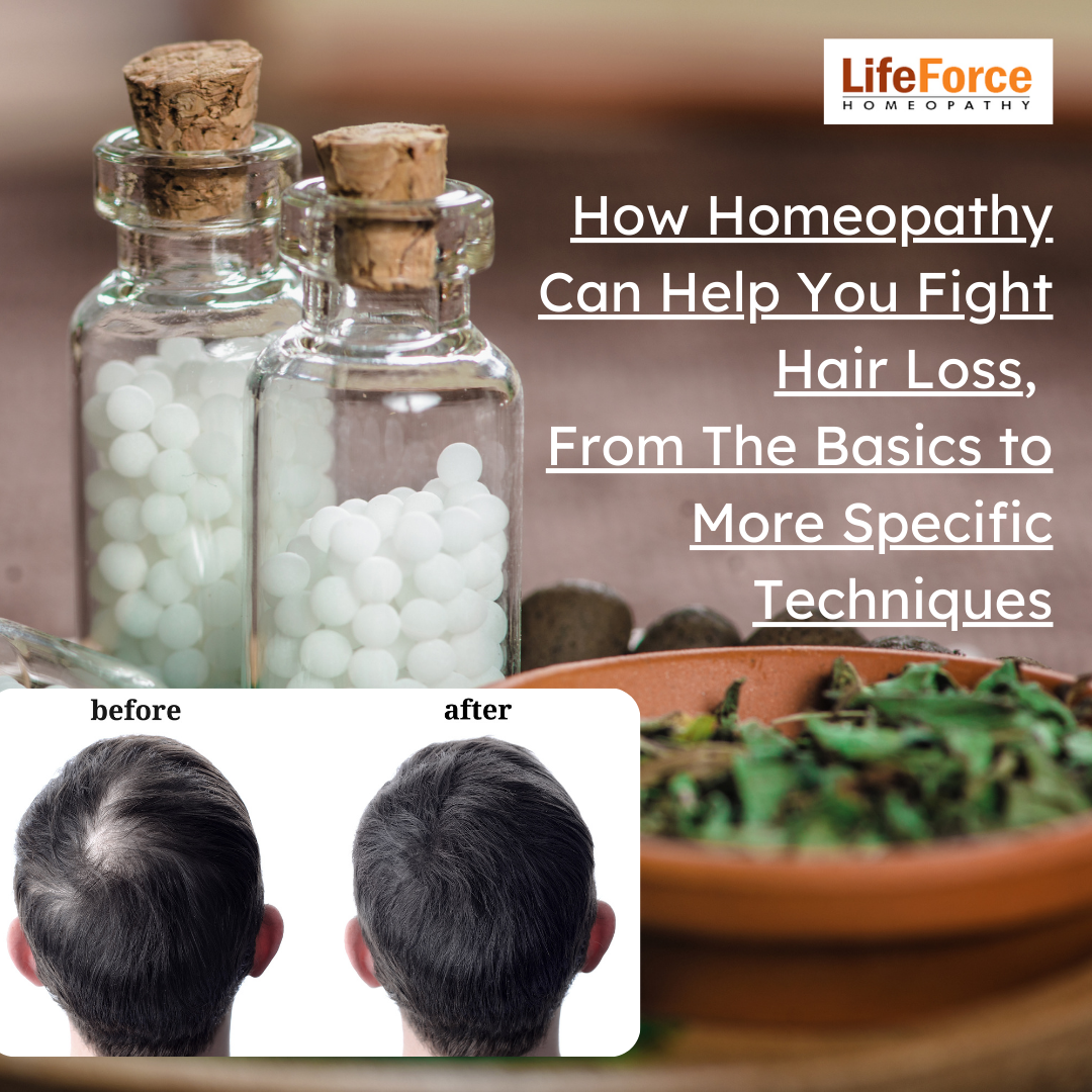 12 Best Foods to Prevent Hair Loss  Upakarma Ayurveda