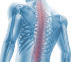 Could your Back Pain be Ankylosing Spondylitis?