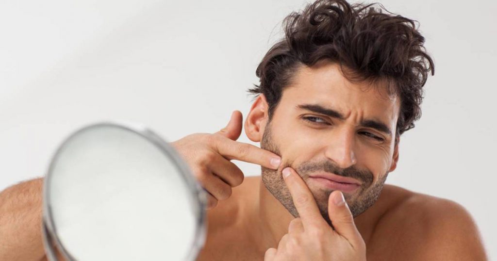 Can Hormonal Changes Cause Acne?