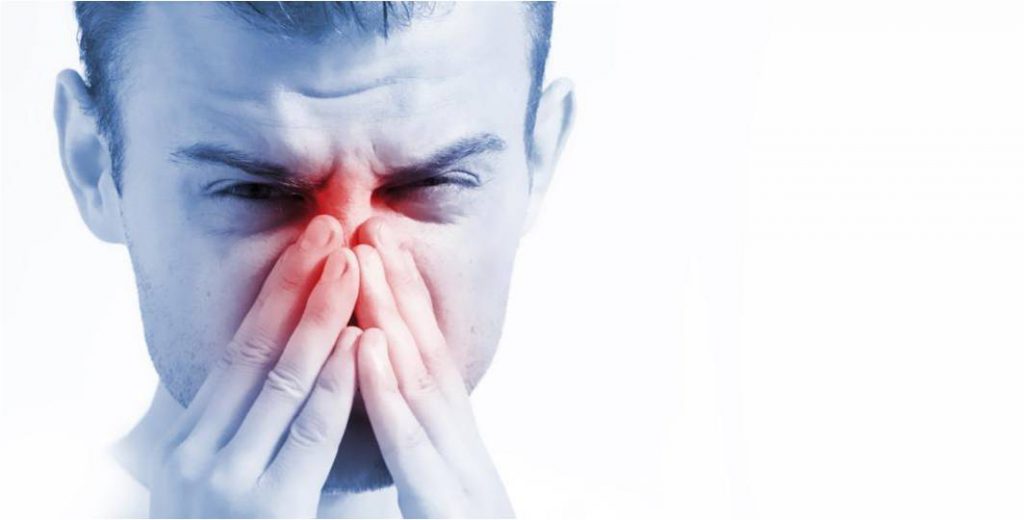 Allergic Rhinitis
