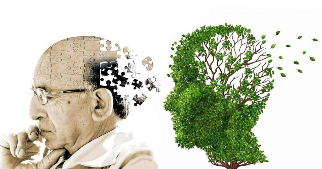 Signs of Alzheimer's : Loss of Memory