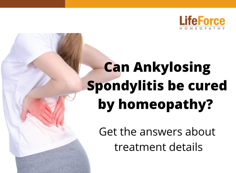 Can Ankylosing Spondylitis be cured by homeopathy?