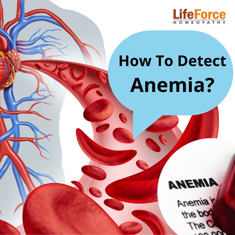 How To Detect Anemia?