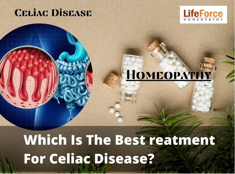 Best Treatment For Celiac Disease?