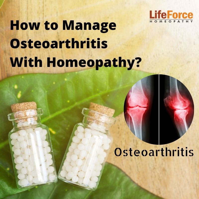 Manage Osteoarthritis With Homeopathy