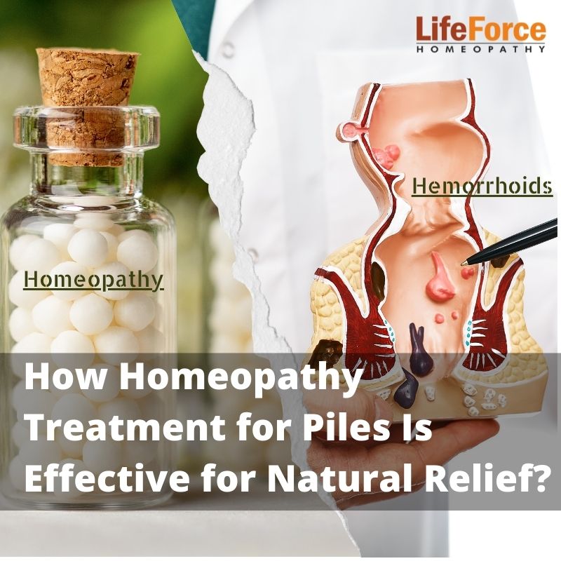 How Homeopathy Treatment for Piles Is Effective for Natural Relief?