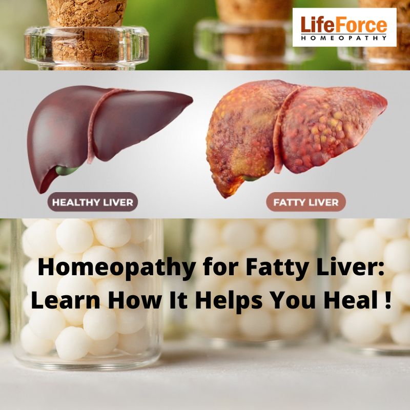 Homeopathy for Fatty Liver: Learn How It Helps You Heal