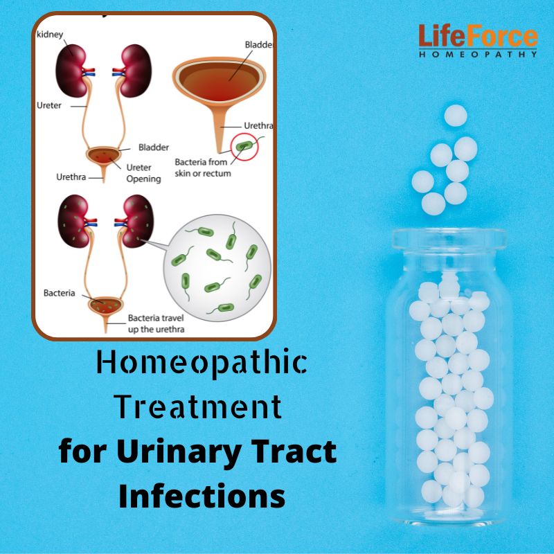 Homeopathic Treatment for UTIs