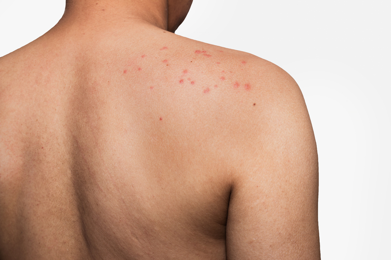 Can Your Simple Skin Rash Be Atopic Dermatitis? It Is Just A Click Away!