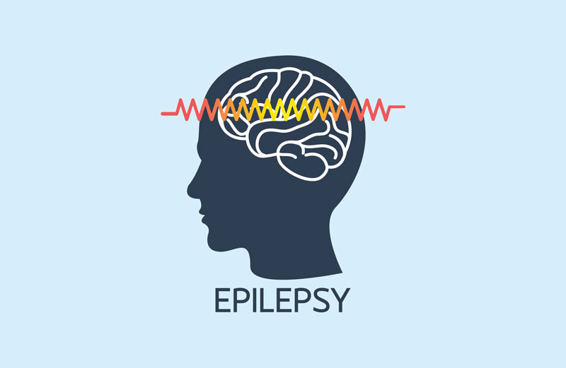All You Wanted To Know About Homeopathic Management For Epilepsy