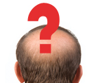 Myths and facts related with Hair Loss