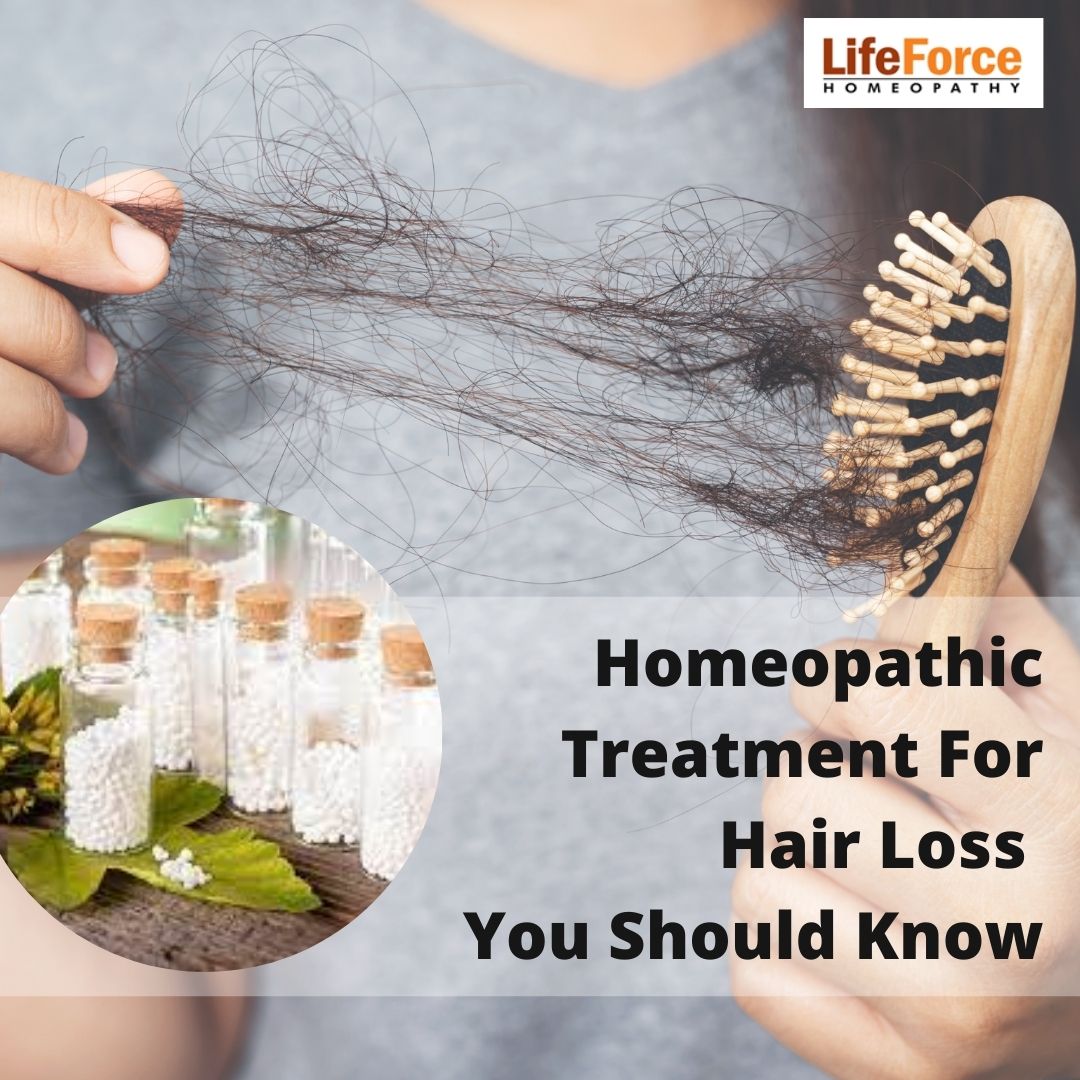Homeopathic Treatment For Hair Loss You Should Know