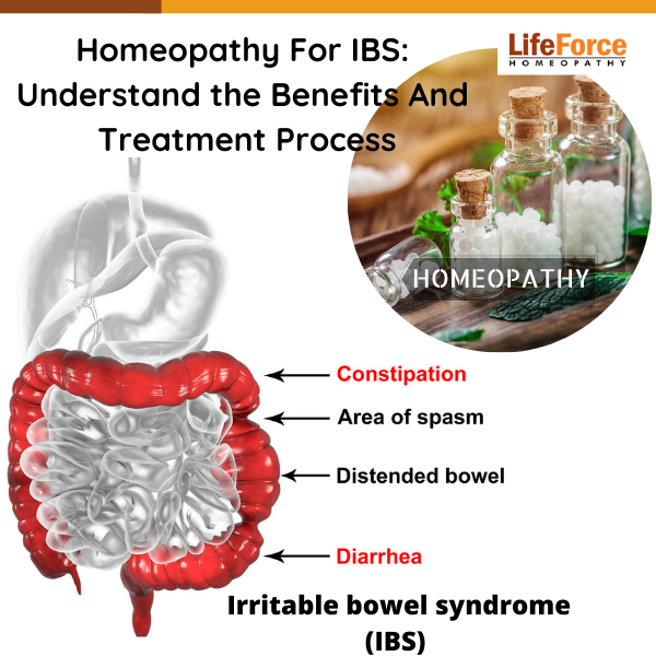 Homeopathy For IBS: Understand the Benefits And Treatment Process
