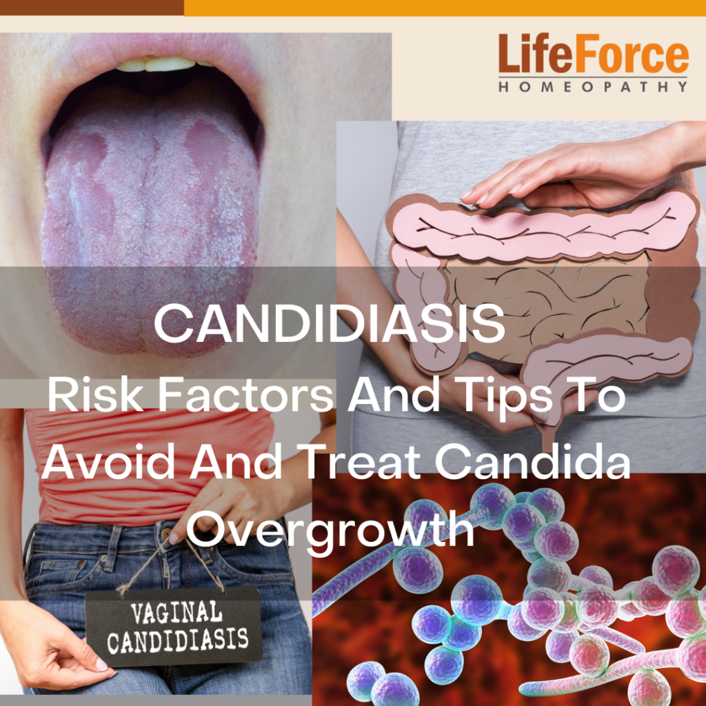 10 Risk Factors And 8 Tips To Avoid And Treat Candida Overgrowth