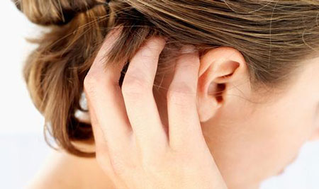 Why does my scalp itch – 5 Common causes of an itchy scalp