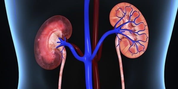 Homeopathic Approach In Treating Kidney Stones And Its Effective Management